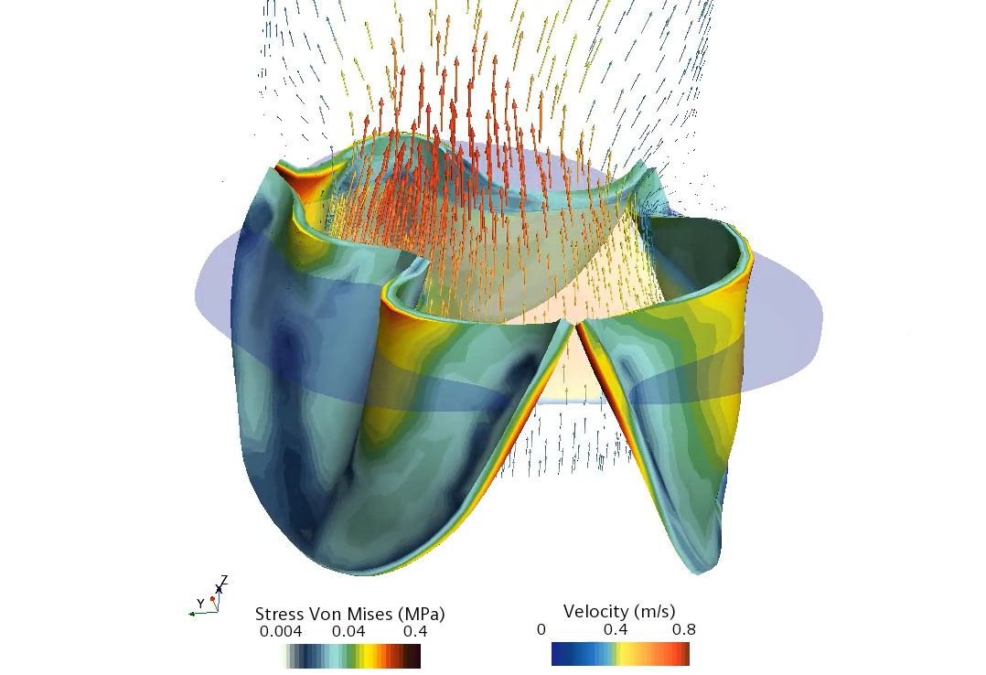 En bild som visar hur visualiseringen av hjärtat, blodflöde och aortaklaffen fungerar.